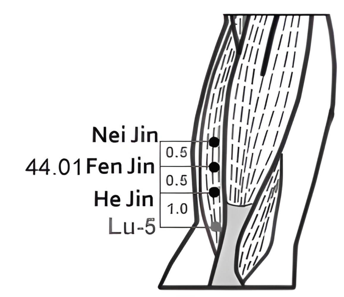 44.01 San Jin
