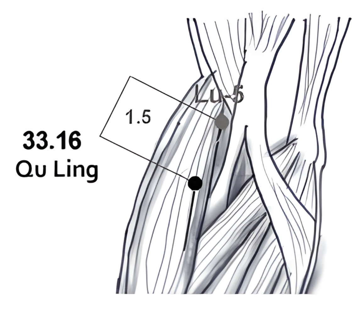 33.16 Qu Ling