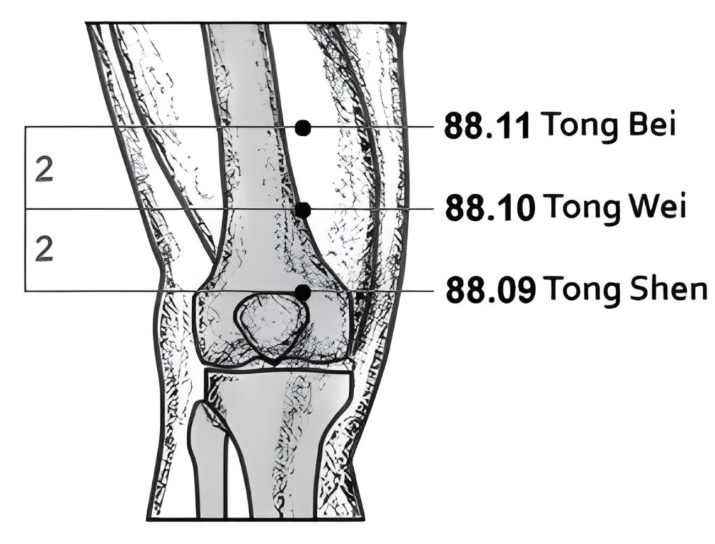 88.09-11 San Tong San