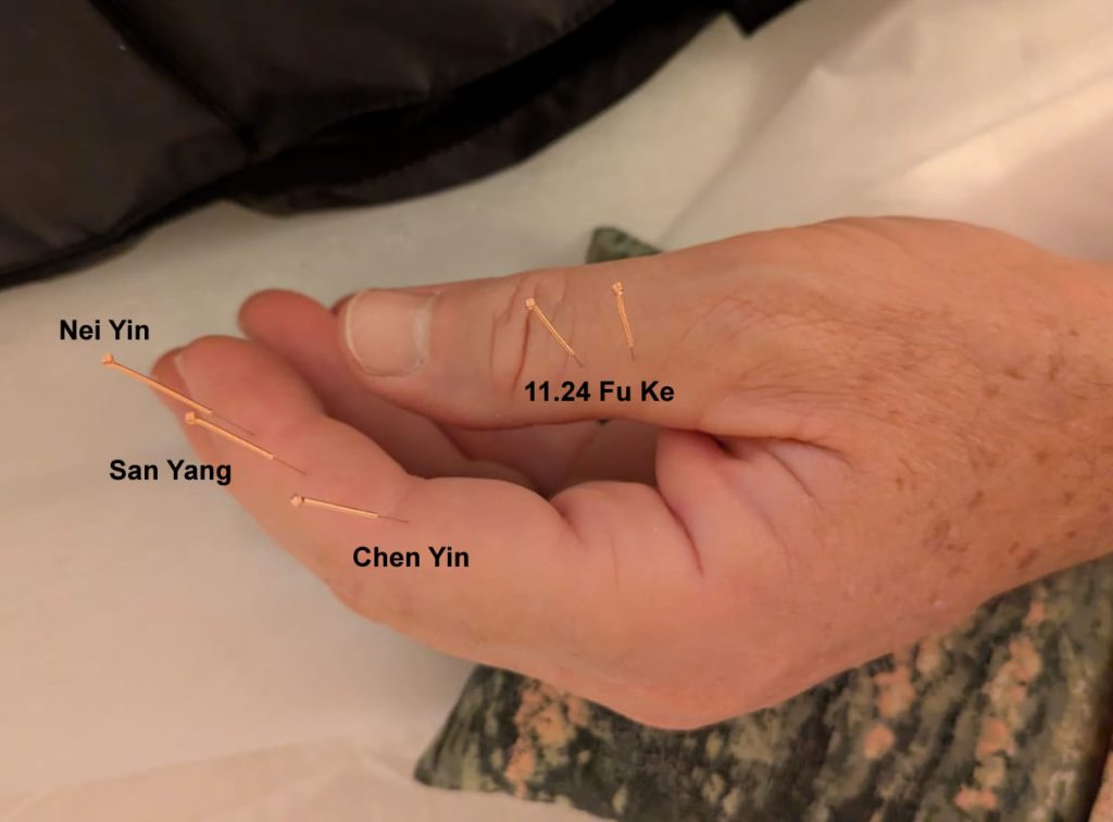 Fu Ke, San Yang, Chen Yin, Nei Yin Fu Ke, San Yang, Chen Yin, Nei Yin