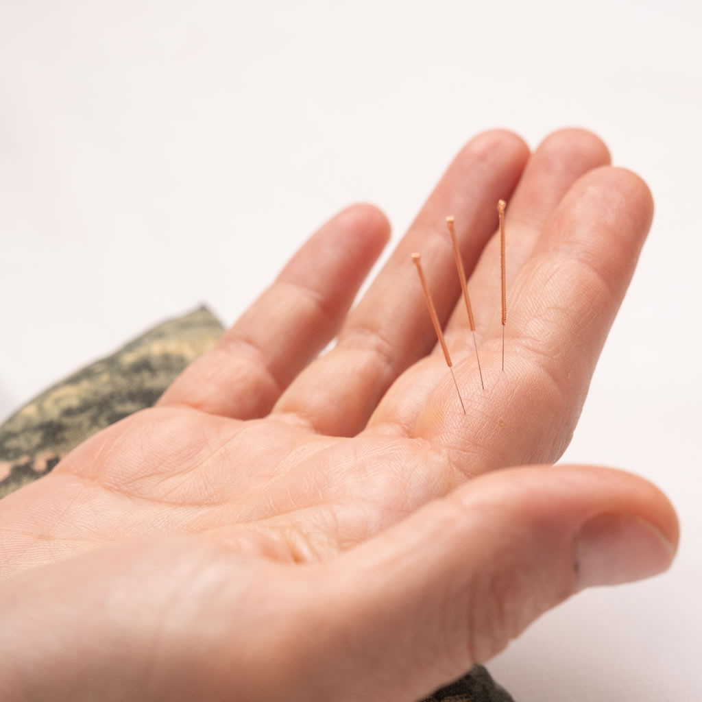 Master Tung's acupuncture case studies