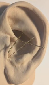 ACTH Point (Adrenocorticotropic Hormone) & Adrenal Gland point