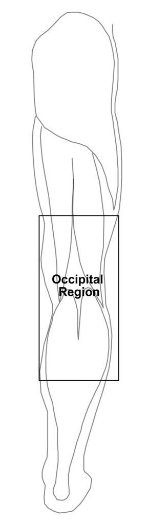 Bloodletting Region 4 Bloodletting Region 4