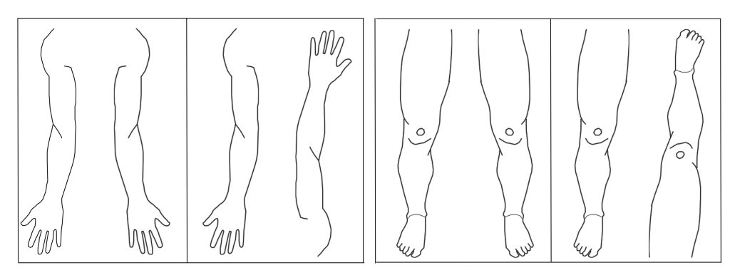 Limb Imaging – Holographic Acupuncture Master Tung's Acupuncture Limb Imaging – Holographic Acupuncture Master Tung's Acupuncture